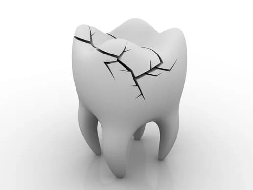 tooth extraction Charlottesville